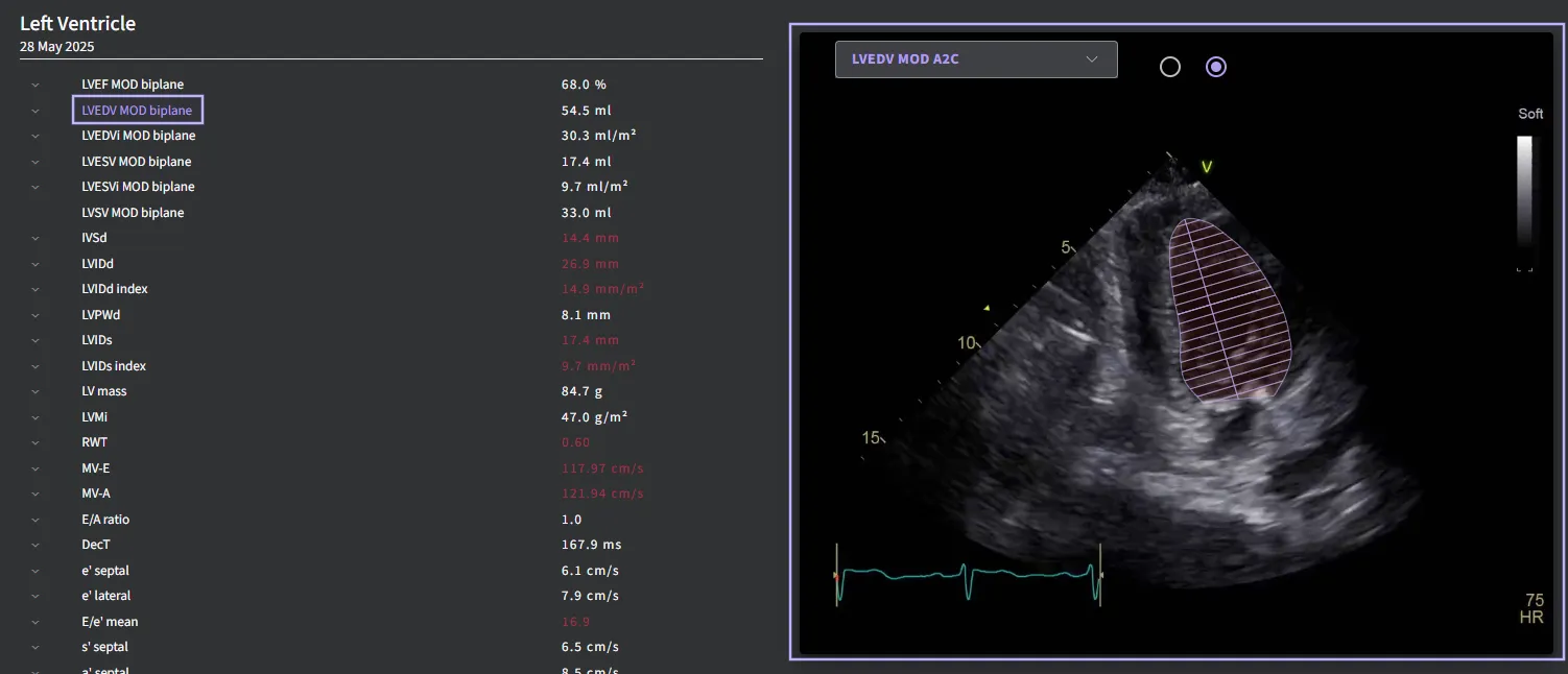                           Click on any measurement or the preview panel to navigate to the measurement page. 